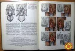 Атлас урогинекологических операций. Д.П.Чухриенко, А.В.Люлько, Н.Т.Романенко