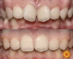 DentalKnysh Ортодонт брекети елайнери